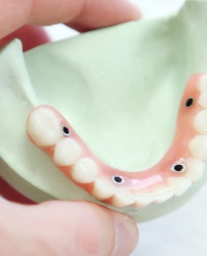 dentalmodel